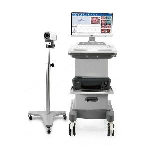 COLPOSCOPE