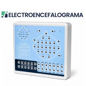 ELECTROENCEFALOGRAMA